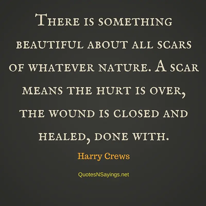 There is something beautiful about all scars of whatever nature. A scar means the hurt is over, the wound is closed and healed, done with - Harry Crews quote